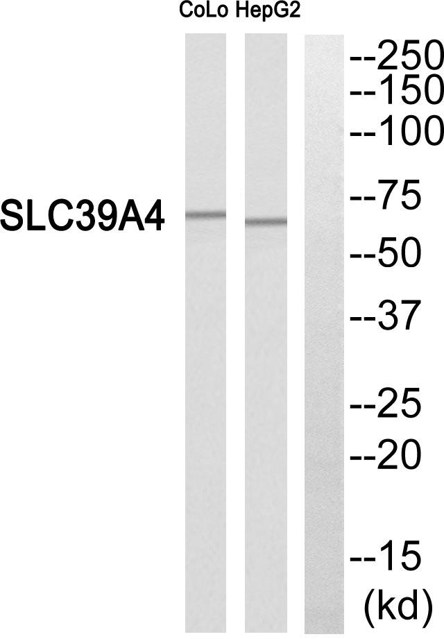SLC39A4 / ZIP4 Antibody - Western blot analysis of extracts from COLO205 cells and HepG2 cells, using SLC39A4 antibody.