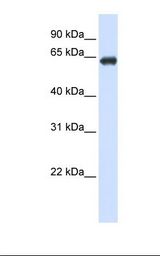 SLC39A4 / ZIP4 Antibody - Transfected 293T cell lysate. Antibody concentration: 1.0 ug/ml. Gel concentration: 12%.  This image was taken for the unconjugated form of this product. Other forms have not been tested.