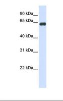 SLC39A4 / ZIP4 Antibody - Transfected 293T cell lysate. Antibody concentration: 1.0 ug/ml. Gel concentration: 12%.  This image was taken for the unconjugated form of this product. Other forms have not been tested.