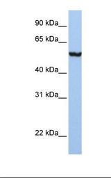 SLC39A5 / ZIP5 Antibody - Placenta lysate. Antibody concentration: 1.0 ug/ml. Gel concentration: 12%.  This image was taken for the unconjugated form of this product. Other forms have not been tested.