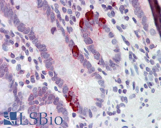 SLC39A5 / ZIP5 Antibody - Anti-SLC39A5 antibody IHC of human small intestine. Immunohistochemistry of formalin-fixed, paraffin-embedded tissue after heat-induced antigen retrieval. Antibody concentration 5 ug/ml.  This image was taken for the unconjugated form of this product. Other forms have not been tested.