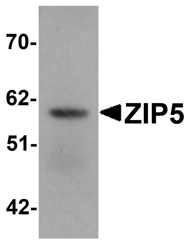 SLC39A5 / ZIP5 Antibody - Western blot analysis of ZIP5 in human spleen tissue lysate with ZIP5 antibody at 1 ug/ml.