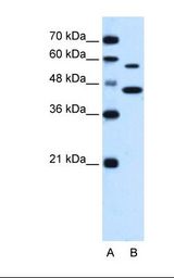 SLC39A5 / ZIP5 Antibody - Lane A: Marker. Lane B: HepG2 cell lysate. Antibody concentration: 0.5 ug/ml. Gel concentration: 12%.  This image was taken for the unconjugated form of this product. Other forms have not been tested.