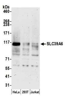 SLC39A6 / LIV-1 Antibody - Detection of human SLC39A6 by western blot. Samples: Whole cell lysate (15 µg) from HeLa, HEK293T, and Jurkat cells prepared using NETN lysis buffer. Antibody: Affinity purified rabbit anti-SLC39A6 antibody used for WB at 0.04 µg/ml. Detection: Chemiluminescence with an exposure time of 3 minutes.
