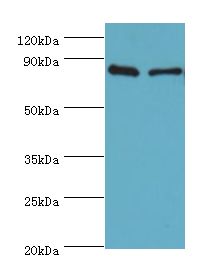 SLC39A6 / LIV-1 Antibody - Western blot. All lanes: SLC39A6 antibody at 10 ug/ml. Lane 1: HeLa whole cell lysate. Lane 2: 293T whole cell lysate. Secondary antibody: Goat polyclonal to rabbit at 1:10000 dilution. Predicted band size: 85 kDa. Observed band size: 85 kDa.