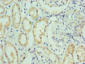 SLC39A6 / LIV-1 Antibody - Immunohistochemistry of paraffin-embedded human kidney tissue using SLC39A6 Antibody at dilution of 1:100