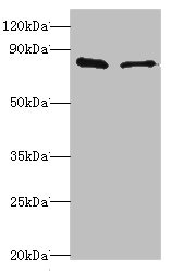 SLC39A6 / LIV-1 Antibody - Western blot All lanes: SLC39A6 antibody at 10µg/ml Lane 1: Hela whole cell lysate Lane 2: 293T whole cell lysate Secondary Goat polyclonal to rabbit IgG at 1/10000 dilution Predicted band size: 86, 49 kDa Observed band size: 86 kDa