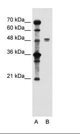 SLC39A6 / LIV-1 Antibody - A: Marker, B: Jurkat Cell Lysate.  This image was taken for the unconjugated form of this product. Other forms have not been tested.