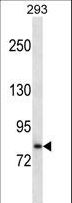 SLC39A6 / LIV-1 Antibody - SLC39A6 Antibody western blot of 293 cell line lysates (35 ug/lane). The SLC39A6 antibody detected the SLC39A6 protein (arrow).