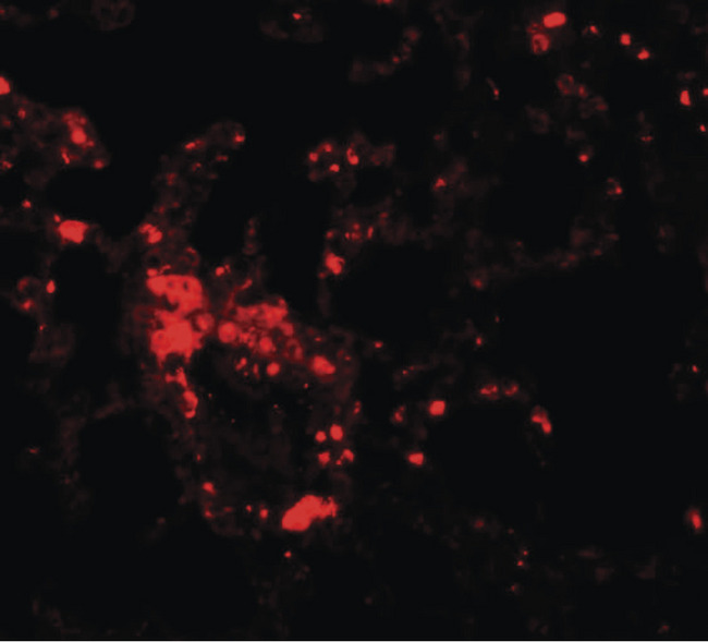 SLC39A6 / LIV-1 Antibody - Immunofluorescence of ZIP6 in mouse lung tissue with ZIP6 antibody at 20 ug/ml.