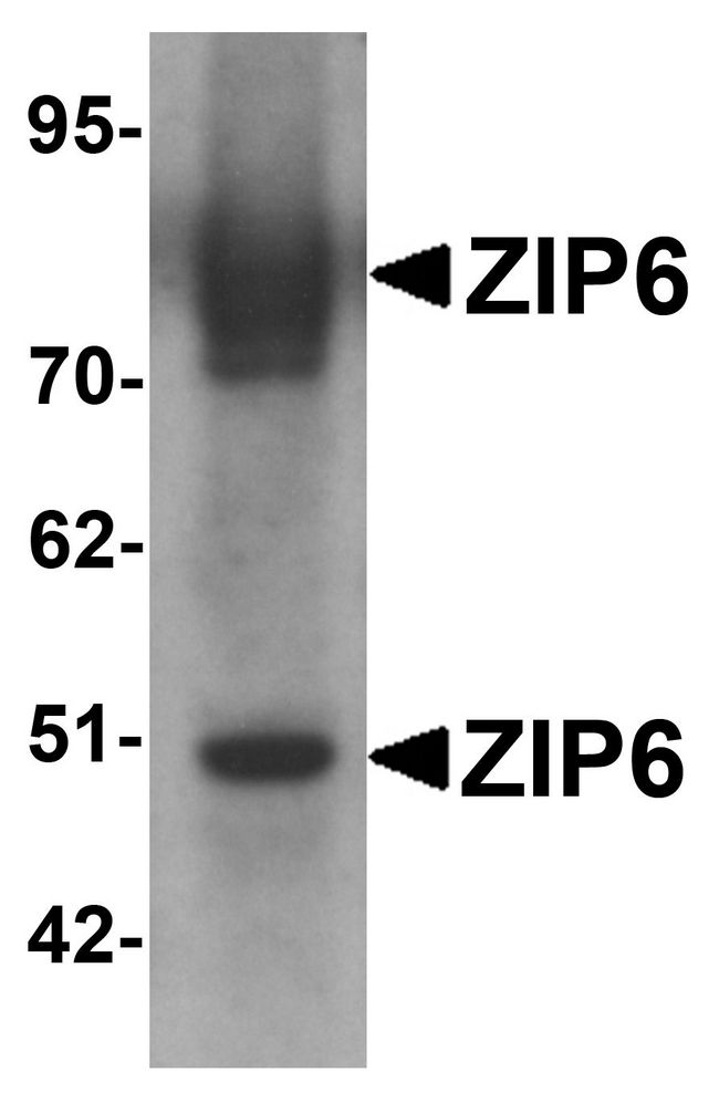SLC39A6 / LIV-1 Antibody - Western blot analysis of ZIP6 in mouse lung tissue lysate with ZIP6 antibody at 1 ug/ml.