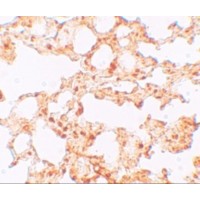 SLC39A6 / LIV-1 Antibody - Immunohistochemistry of ZIP6 in mouse lung tissue with ZIP6 antibody at 5 µg/mL.
