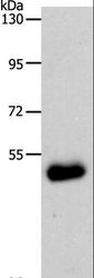 SLC39A6 / LIV-1 Antibody - Western blot analysis of Human colon cancer tissue, using SLC39A6 Polyclonal Antibody at dilution of 1:500.