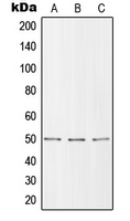 SLC39A7 / ZIP7 Antibody - Western blot analysis of ZIP7 expression in MCF7 (A); SP2/0 (B); H9C2 (C) whole cell lysates.