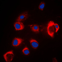 SLC39A7 / ZIP7 Antibody - Immunofluorescent analysis of ZIP7 staining in MCF7 cells. Formalin-fixed cells were permeabilized with 0.1% Triton X-100 in TBS for 5-10 minutes and blocked with 3% BSA-PBS for 30 minutes at room temperature. Cells were probed with the primary antibody in 3% BSA-PBS and incubated overnight at 4 C in a humidified chamber. Cells were washed with PBST and incubated with a DyLight 594-conjugated secondary antibody (red) in PBS at room temperature in the dark. DAPI was used to stain the cell nuclei (blue).
