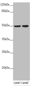 SLC39A7 / ZIP7 Antibody - Western blot All Lanes: SLC39A7 antibody at 4.06 ug/ml Lane 1: MCF7 whole cell lysate Lane 2: HepG-2 whole cell lysate Secondary Goat polyclonal to rabbit IgG at 1/10000 dilution Predicted band size: 50 kDa Observed band size: 50 kDa