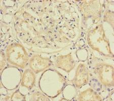 SLC39A7 / ZIP7 Antibody - Immunohistochemistry of paraffin-embedded human kidney tissue at dilution of 1:100