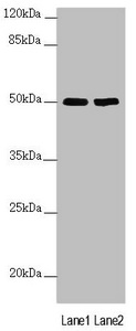 SLC39A7 / ZIP7 Antibody - Western blot All Lanes: SLC39A7 antibody at 3.59 ug/ml Lane 1: MCF7 whole cell lysate Lane 2: HepG-2 whole cell lysate Secondary Goat polyclonal to rabbit IgG at 1/10000 dilution Predicted band size: 50 kDa Observed band size: 50 kDa