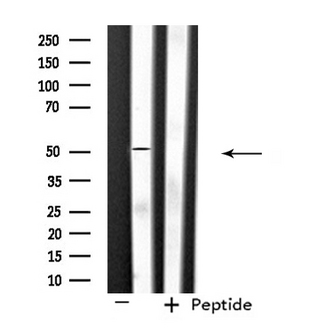 SLC39A7 / ZIP7 Antibody - Western blot analysis of extracts of 293 cells using SLC39A7 antibody.