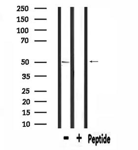 SLC39A7 / ZIP7 Antibody - Western blot analysis of extracts of mouse brain tissue using SLC39A7 antibody.