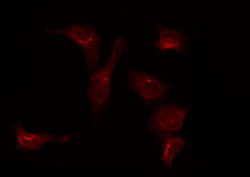 SLC39A7 / ZIP7 Antibody - Staining 293 cells by IF/ICC. The samples were fixed with PFA and permeabilized in 0.1% Triton X-100, then blocked in 10% serum for 45 min at 25°C. The primary antibody was diluted at 1:200 and incubated with the sample for 1 hour at 37°C. An Alexa Fluor 594 conjugated goat anti-rabbit IgG (H+L) Ab, diluted at 1/600, was used as the secondary antibody.