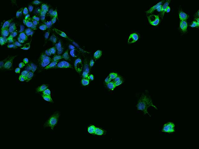 SLC39A7 / ZIP7 Antibody - Immunofluorescence staining of SLC39A7 in HepG2 cells. Cells were fixed with 4% PFA, permeabilzed with 0.1% Triton X-100 in PBS, blocked with 10% serum, and incubated with rabbit anti-Human SLC39A7 polyclonal antibody (dilution ratio 1:200) at 4°C overnight. Then cells were stained with the Alexa Fluor 488-conjugated Goat Anti-rabbit IgG secondary antibody (green) and counterstained with DAPI (blue). Positive staining was localized to Cytoplasm.