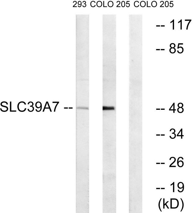 SLC39A7 / ZIP7 Antibody - Western blot analysis of extracts from 293 cells and COLO cells, using SLC39A7 antibody.