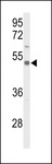 SLC39A8 / ZIP8 Antibody - Western blot of S39A8 Antibody in CEM cell line lysates (35 ug/lane). S39A8 (arrow) was detected using the purified antibody.