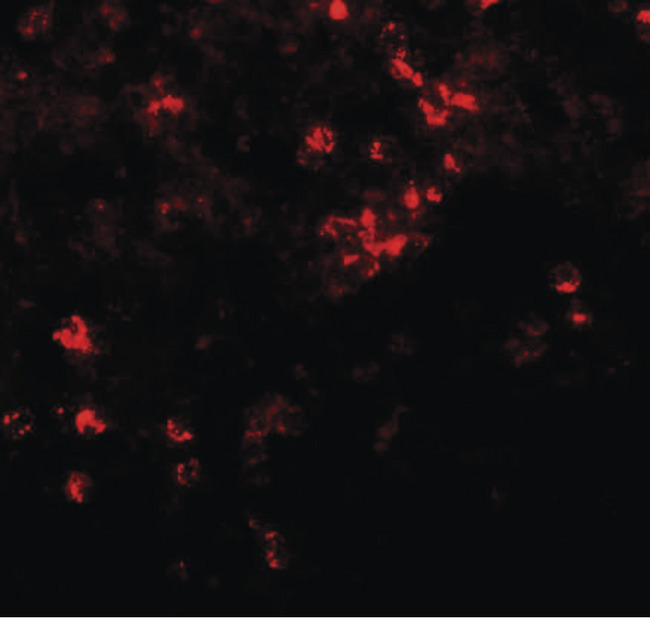 SLC39A8 / ZIP8 Antibody - Immunofluorescence of ZIP8 in human spleen tissue with ZIP8 antibody at 20 ug/ml.
