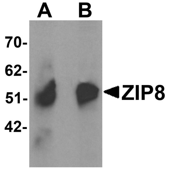 SLC39A8 / ZIP8 Antibody - Western blot analysis of ZIP8 in human spleen tissue lysate with ZIP8 antibody at (A) 1 and (B) 2 ug/ml.