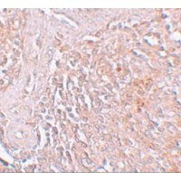 SLC39A8 / ZIP8 Antibody - Immunohistochemistry of ZIP8 in human spleen tissue with ZIP8 antibody at 5 µg/mL.
