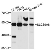 SLC39A8 / ZIP8 Antibody - Western blot analysis of extracts of various cell lines, using SLC39A8 antibody at 1:1000 dilution. The secondary antibody used was an HRP Goat Anti-Rabbit IgG (H+L) at 1:10000 dilution. Lysates were loaded 25ug per lane and 3% nonfat dry milk in TBST was used for blocking. An ECL Kit was used for detection and the exposure time was 90s.
