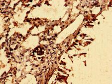 SLC39A8 / ZIP8 Antibody - Immunohistochemistry image of paraffin-embedded human lung tissue at a dilution of 1:100