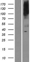 SLC39A8 / ZIP8 Protein - Western validation with an anti-DDK antibody * L: Control HEK293 lysate R: Over-expression lysate