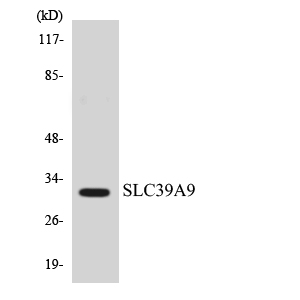 SLC39A9 Antibody - Western blot analysis of the lysates from HeLa cells using SLC39A9 antibody.