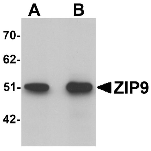 SLC39A9 Antibody - Western blot analysis of ZIP9 in HepG2 cell lysate with ZIP9 antibody at (A) 1 and (B) 2 ug/ml.