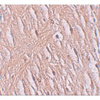 SLC39A9 Antibody - Immunohistochemistry of ZIP9 in human brain tissue with ZIP9 antibody at 2.5 µg/mL.