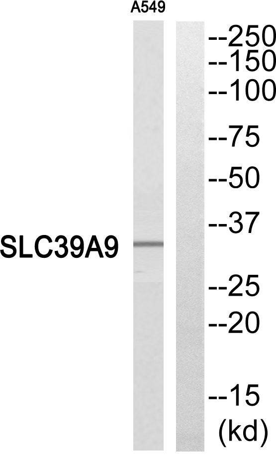 SLC39A9 Antibody - Western blot analysis of extracts from A549 cells, using SLC39A9 antibody.