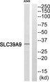 SLC39A9 Antibody - Western blot analysis of extracts from A549 cells, using SLC39A9 antibody.