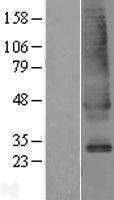 SLC39A9 Protein - Western validation with an anti-DDK antibody * L: Control HEK293 lysate R: Over-expression lysate