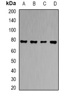 SLC3A1 / ATR1 Antibody - Western blot analysis of RBAT expression in HT29 (A); HepG2 (B); PC12 (C); mouse liver (D) whole cell lysates.