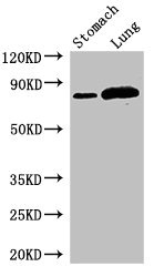 SLC3A1 / ATR1 Antibody - Western Blot Positive WB detected in:Mouse stomach tissue,Rat lung tissue All Lanes:SLC3A1 antibody at 2.8µg/ml Secondary Goat polyclonal to rabbit IgG at 1/50000 dilution Predicted band size: 79,47,46,36,58,67,64 KDa Observed band size: 79 KDa