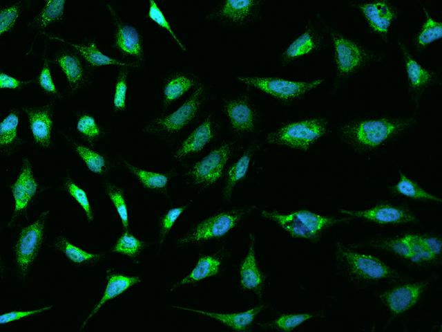 SLC3A1 / ATR1 Antibody - Immunofluorescence staining of SLC3A1 in HeLa cells. Cells were fixed with 4% PFA, permeabilzed with 0.1% Triton X-100 in PBS, blocked with 10% serum, and incubated with rabbit anti-Human SLC3A1 polyclonal antibody (dilution ratio 1:200) at 4°C overnight. Then cells were stained with the Alexa Fluor 488-conjugated Goat Anti-rabbit IgG secondary antibody (green) and counterstained with DAPI (blue). Positive staining was localized to Cytoplasm.