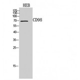 SLC3A2 / CD98 Heavy Chain Antibody - Western blot of CD98 antibody