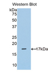 SLC3A2 / CD98 Heavy Chain Antibody - Western blot of SLC3A2 / CD98 Heavy Chain antibody.