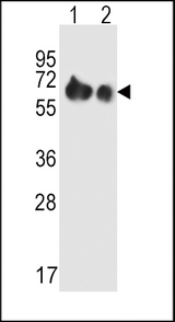 SLC3A2 / CD98 Heavy Chain Antibody - SLC3A2 Antibody western blot of A2058(lane 1),A375(lane 2) cell line lysates (35 ug/lane). The SLC3A2 antibody detected the SLC3A2 protein (arrow).