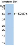SLC40A1 / Ferroportin-1 Antibody - Western blot of recombinant SLC40A1 / Ferroportin-1.  This image was taken for the unconjugated form of this product. Other forms have not been tested.