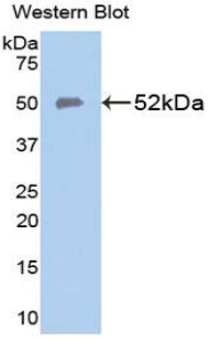 SLC40A1 / Ferroportin-1 Antibody - Western blot of recombinant SLC40A1 / Ferroportin-1.  This image was taken for the unconjugated form of this product. Other forms have not been tested.