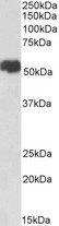 SLC40A1 / Ferroportin-1 Antibody - Goat Anti-SLC40A1 (aa245-259) Antibody (1µg/ml) staining of Breast Cancer lysate (35µg protein in RIPA buffer). Detected by chemiluminescencence.