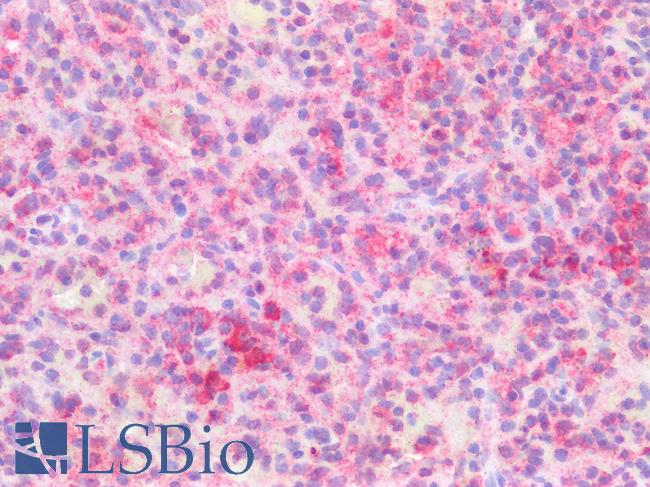 SLC40A1 / Ferroportin-1 Antibody - Human Spleen: Formalin-Fixed, Paraffin-Embedded (FFPE)